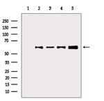 Phospho-AKT1 (Thr450) Antibody in Western Blot (WB)