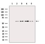 Phospho-AKT1 (Thr450) Antibody in Western Blot (WB)