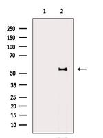 Phospho-AKT1 (Thr450) Antibody in Western Blot (WB)