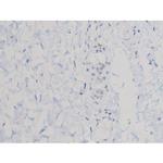 Phospho-AKT1 (Thr450) Antibody in Immunohistochemistry (Paraffin) (IHC (P))