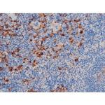 Phospho-AKT1 (Thr450) Antibody in Immunohistochemistry (Paraffin) (IHC (P))