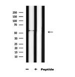 Phospho-AKT1 (Thr450) Antibody in Western Blot (WB)