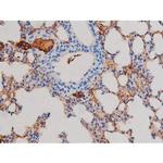 Phospho-AKT1 (Ser124) Antibody in Immunohistochemistry (Paraffin) (IHC (P))