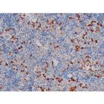 Phospho-AKT1 (Ser124) Antibody in Immunohistochemistry (Paraffin) (IHC (P))