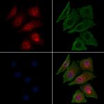 Phospho-AKT2 (Ser474) Antibody in Immunocytochemistry (ICC/IF)