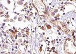 Phospho-AKT2 (Ser474) Antibody in Immunohistochemistry (Paraffin) (IHC (P))