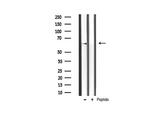 Phospho-AKT2 (Ser474) Antibody in Western Blot (WB)