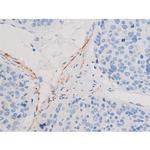 Phospho-IRS1 (Ser636) Antibody in Immunohistochemistry (Paraffin) (IHC (P))