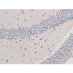 Phospho-IRS1 (Ser636) Antibody in Immunohistochemistry (Paraffin) (IHC (P))