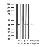 Phospho-IRS1 (Ser636) Antibody in Western Blot (WB)