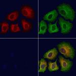 Phospho-IRS1 (Ser639) Antibody in Immunocytochemistry (ICC/IF)