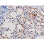 Phospho-IRS1 (Ser639) Antibody in Immunohistochemistry (Paraffin) (IHC (P))