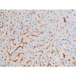 Phospho-IRS1 (Ser639) Antibody in Immunohistochemistry (Paraffin) (IHC (P))