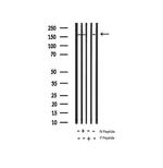 Phospho-IRS1 (Ser639) Antibody in Western Blot (WB)