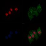 Phospho-PPAR gamma (Ser112) Antibody in Immunocytochemistry (ICC/IF)