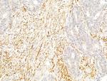 Phospho-PPAR gamma (Ser112) Antibody in Immunohistochemistry (Paraffin) (IHC (P))