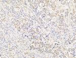 Phospho-PPAR gamma (Ser112) Antibody in Immunohistochemistry (Paraffin) (IHC (P))