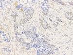 Phospho-PPAR gamma (Ser112) Antibody in Immunohistochemistry (Paraffin) (IHC (P))