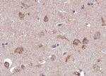 Phospho-TPL2 (Thr290) Antibody in Immunohistochemistry (Paraffin) (IHC (P))