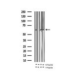 Phospho-TPL2 (Thr290) Antibody in Western Blot (WB)