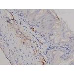 Phospho-STAT6 (Tyr641) Antibody in Immunohistochemistry (Paraffin) (IHC (P))