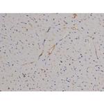 Phospho-STAT6 (Tyr641) Antibody in Immunohistochemistry (Paraffin) (IHC (P))