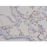 Phospho-STAT6 (Tyr641) Antibody in Immunohistochemistry (Paraffin) (IHC (P))