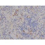 Phospho-STAT6 (Tyr641) Antibody in Immunohistochemistry (Paraffin) (IHC (P))