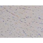 Phospho-STAT6 (Tyr641) Antibody in Immunohistochemistry (Paraffin) (IHC (P))