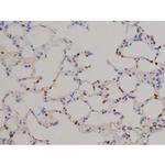 Phospho-STAT6 (Tyr641) Antibody in Immunohistochemistry (Paraffin) (IHC (P))