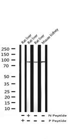 Phospho-STAT6 (Tyr641) Antibody in Western Blot (WB)