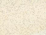 Phospho-STAT6 (Tyr641) Antibody in Immunohistochemistry (Paraffin) (IHC (P))