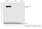 Phospho-STAT6 (Tyr641) Antibody in Western Blot (WB)