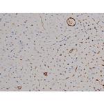 Phospho-STAT6 (Thr645) Antibody in Immunohistochemistry (Paraffin) (IHC (P))