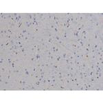 Phospho-STAT6 (Thr645) Antibody in Immunohistochemistry (Paraffin) (IHC (P))