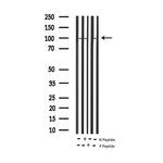 Phospho-STAT6 (Thr645) Antibody in Western Blot (WB)