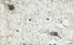 Phospho-mTOR (Ser2481) Antibody in Immunohistochemistry (Paraffin) (IHC (P))