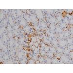 Phospho-ZAP-70 (Tyr319) Antibody in Immunohistochemistry (Paraffin) (IHC (P))