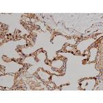 Phospho-ZAP-70 (Tyr319) Antibody in Immunohistochemistry (Paraffin) (IHC (P))