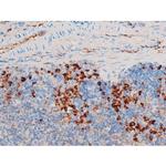 Phospho-SYK (Tyr348) Antibody in Immunohistochemistry (Paraffin) (IHC (P))