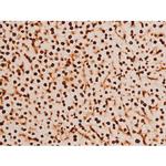 Phospho-SYK (Tyr348) Antibody in Immunohistochemistry (Paraffin) (IHC (P))