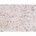 Phospho-SYK (Tyr348) Antibody in Immunohistochemistry (Paraffin) (IHC (P))