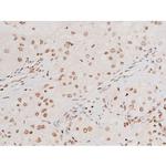 Phospho-SYK (Tyr348) Antibody in Immunohistochemistry (Paraffin) (IHC (P))