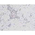 Phospho-SYK (Tyr525) Antibody in Immunohistochemistry (Paraffin) (IHC (P))