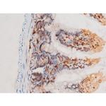 Phospho-SYK (Tyr525) Antibody in Immunohistochemistry (Paraffin) (IHC (P))