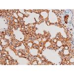 Phospho-SYK (Tyr525) Antibody in Immunohistochemistry (Paraffin) (IHC (P))