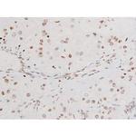 Phospho-SYK (Tyr525) Antibody in Immunohistochemistry (Paraffin) (IHC (P))