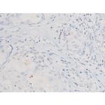 Phospho-SYK (Tyr525) Antibody in Immunohistochemistry (Paraffin) (IHC (P))