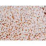 Phospho-SYK (Tyr525) Antibody in Immunohistochemistry (Paraffin) (IHC (P))