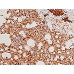 Phospho-SYK (Tyr525) Antibody in Immunohistochemistry (Paraffin) (IHC (P))